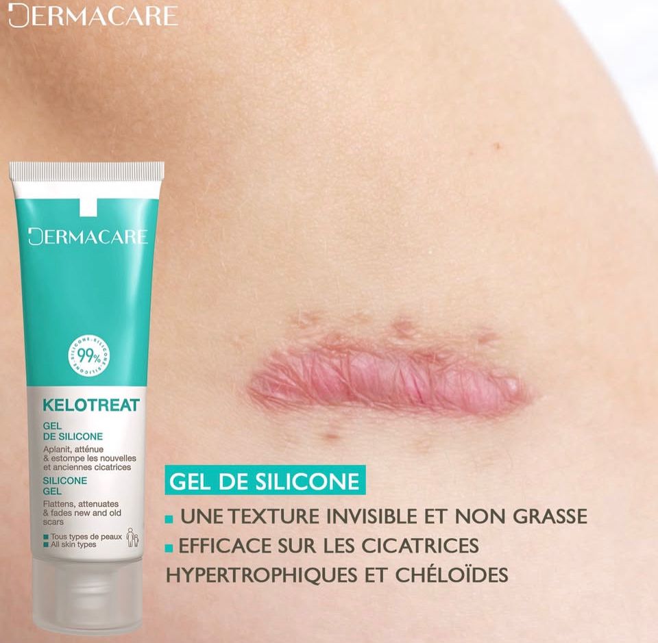 DERMACARE KELO TREAT 50ML